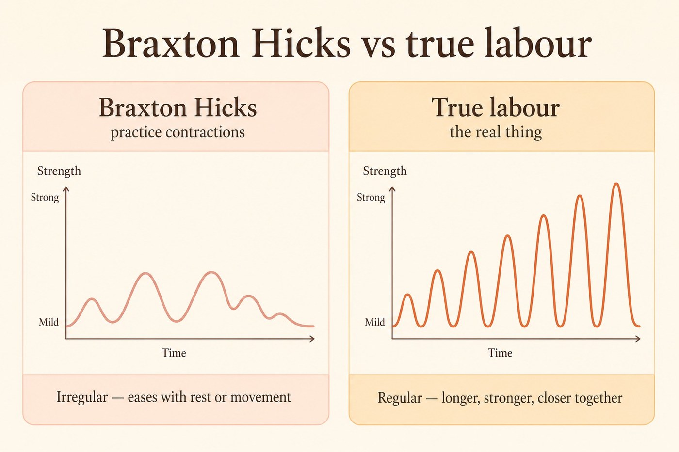 Comparison of Braxton Hicks and true labour contractions, showing an irregular fading pattern against a regular pattern that grows stronger